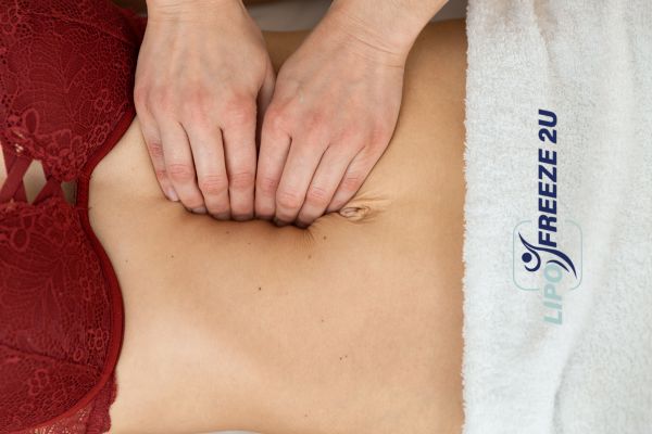diastasis recti treatment St Ives