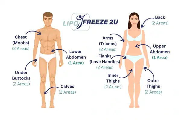Areas you can have fat freezing treatment St Ives