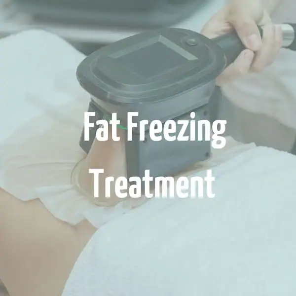 fat freezing treatment St Ives