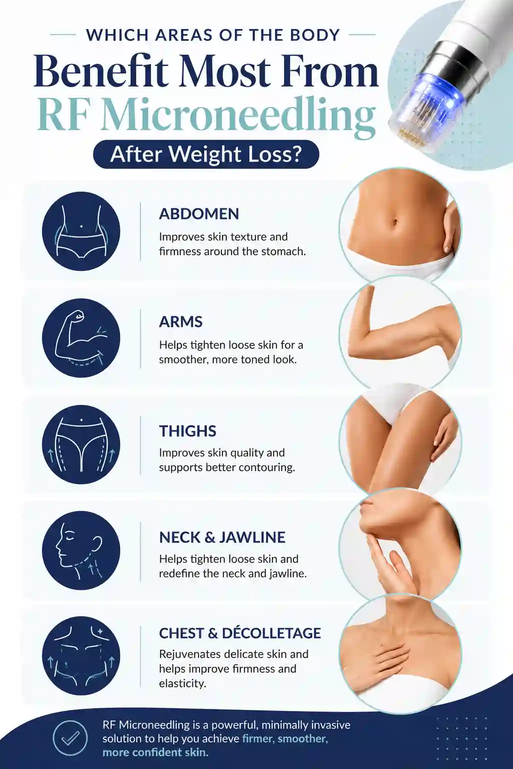 Which Areas of the Body Benefit Most From RF Microneedling After Weight Loss St Ives